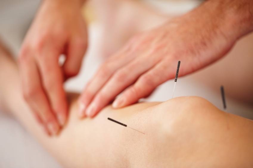 Le syndrome de Guillain-Barré traité par l'acupuncture à Lyon