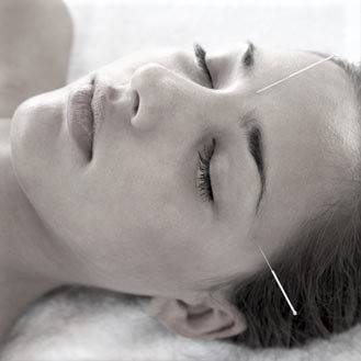 Sinusite aiguë et chronique traitée par acupuncture à Lyon